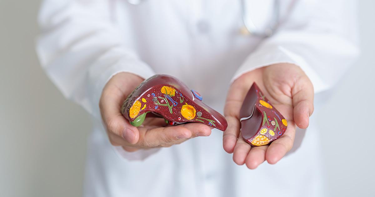 Hoe ontstaat leververvetting? Jo Panuwat D / Shutterstock.com